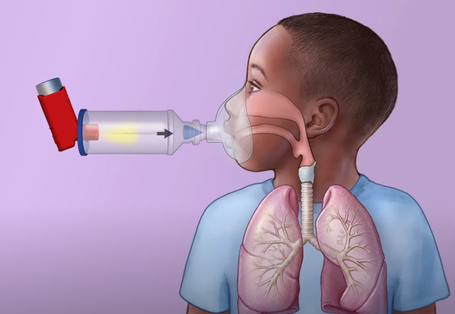 Graphical representation of a boy using oral corticosteroids